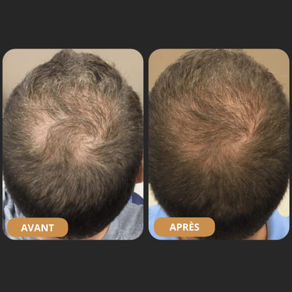 TITAN™ Shampooing Activateur de Repousse — Stimule la Repousse et la Densité avec Seulement 4 Lavages par Semaine*