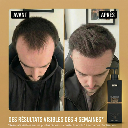 TITAN™ Shampooing Activateur de Repousse — Stimule la Repousse et la Densité avec Seulement 4 Lavages par Semaine*