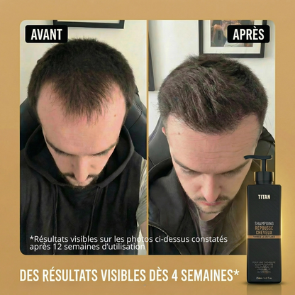 TITAN™ — Stoppe la Chute et Relance la Repousse dès 4 Semaines